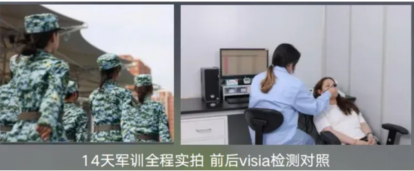 云开体育开展为期14天的高强度防晒执行-开云官网登录入口 开云KaiyunApp官网入口